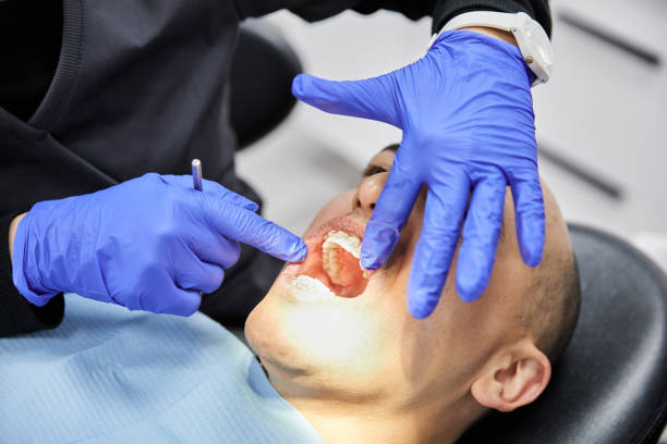 Best Emergency Dental Care for Broken or Chipped Teeth in Middlesex, NJ